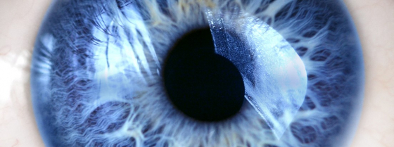 cataract oog